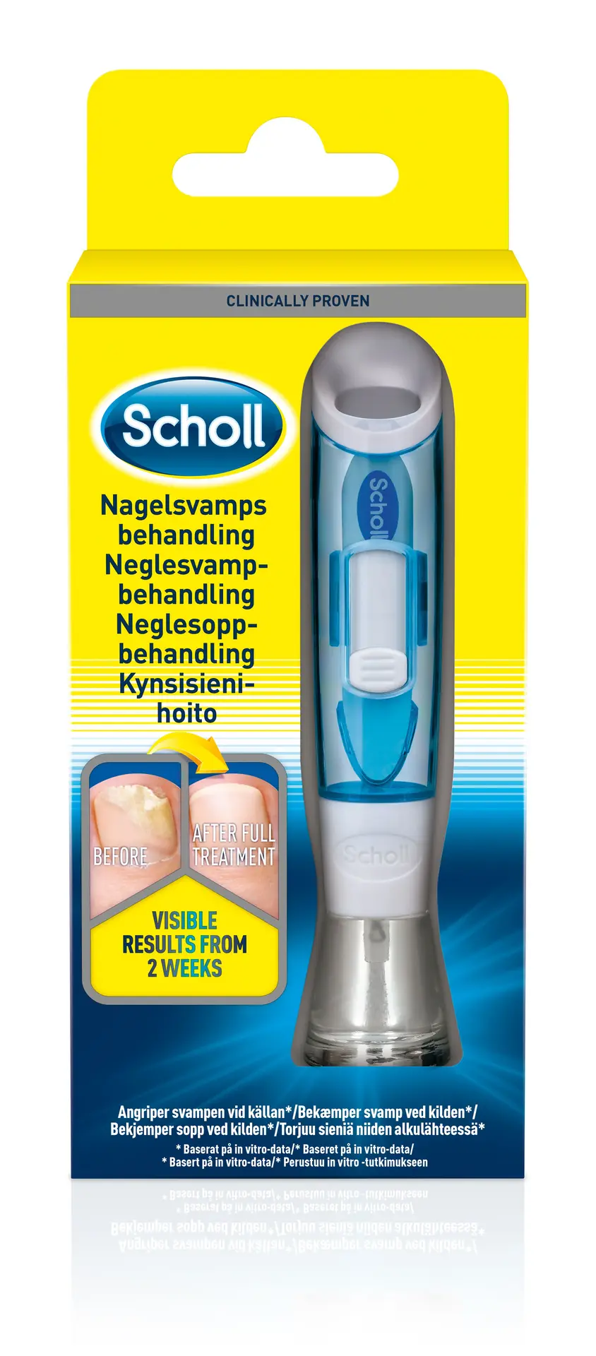 neglesopp